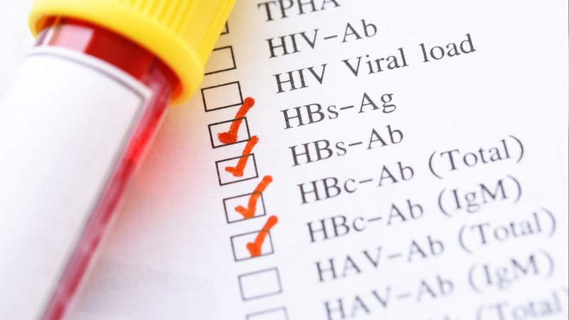 Anti-HBc IgM: Xét Nghiệm Quan Trọng Trong Chẩn Đoán Viêm Gan B Cấp Tính 4