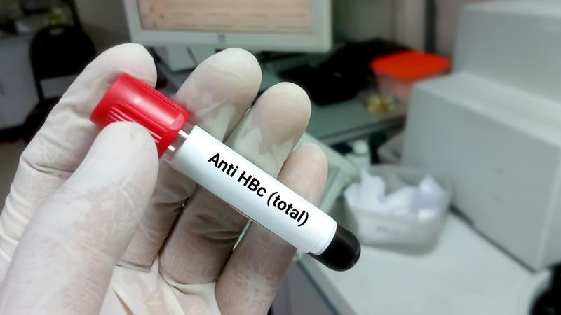 Anti HBc là gì? Những điều cần biết về xét nghiệm kháng thể Anti HBc 2