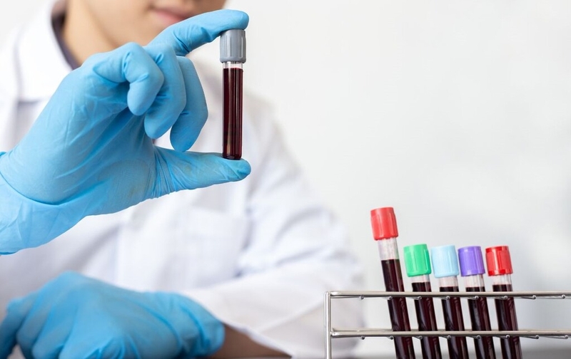 Anti HBc là gì? Những điều cần biết về xét nghiệm kháng thể Anti HBc 1