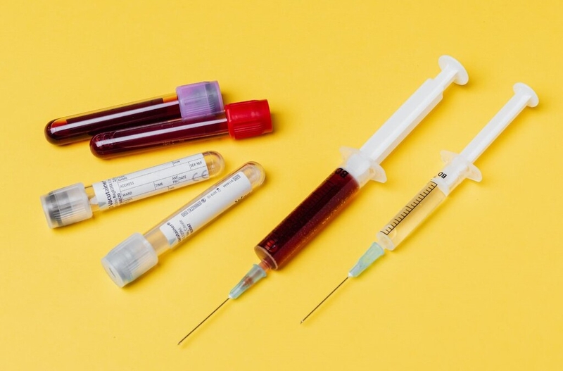 Anti HBc là gì? Những điều cần biết về xét nghiệm kháng thể Anti HBc 3