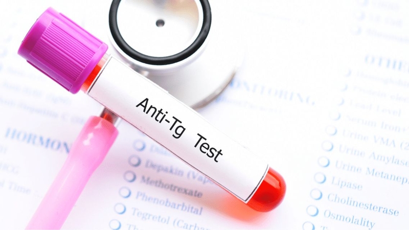 Kết quả Anti TG cần được đánh giá cùng các xét nghiệm tuyến giáp khác