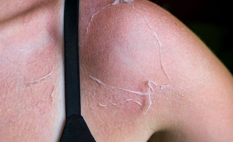 Mặc áo chống nắng có tránh được tia UV không 1