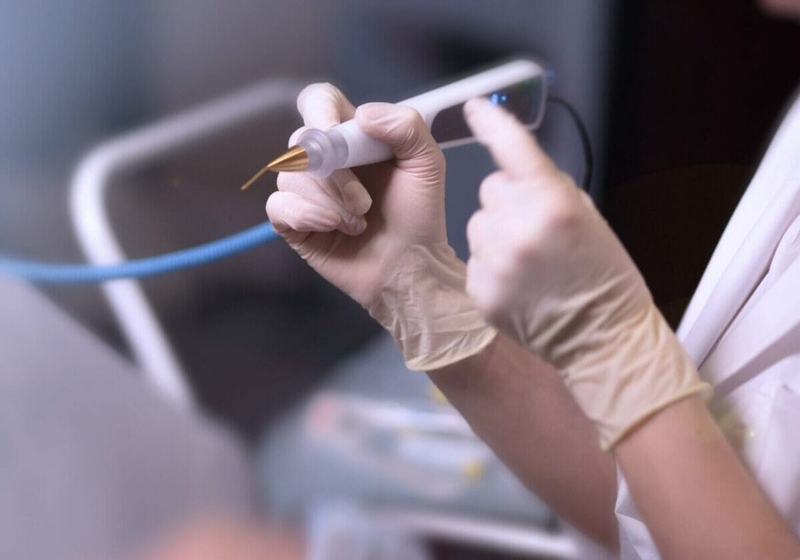 Áp lạnh cổ tử cung để điều trị viêm lộ tuyến 1