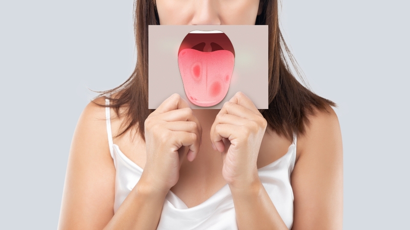 Môi trường khoang miệng không được làm sạch đúng cách tạo điều kiện cho vi khuẩn tích tụ và phát triển