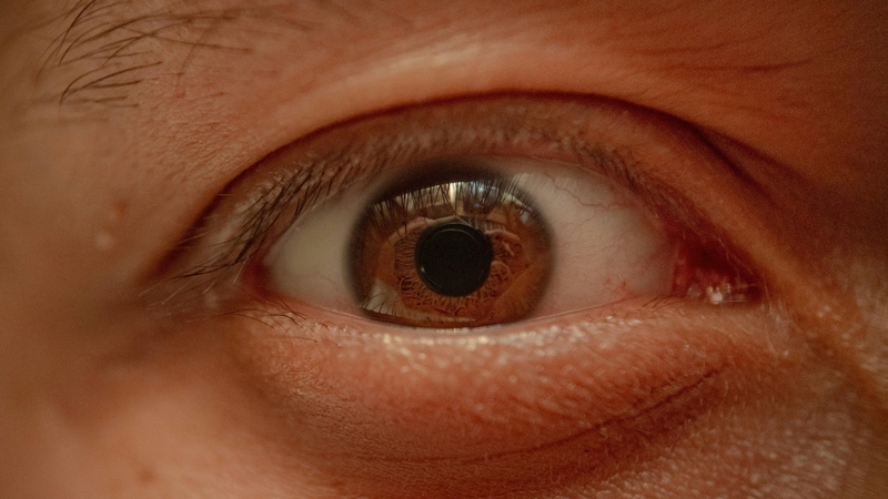 Nhiễm trùng từ vùng lân cận gây áp xe mắt