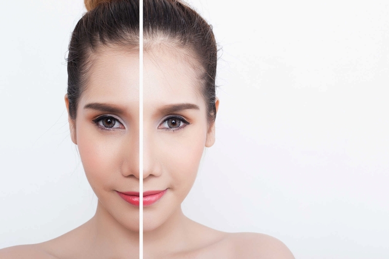 Arbutin là hợp chất gì? Có thể trị nám bằng arbutin được không? 2