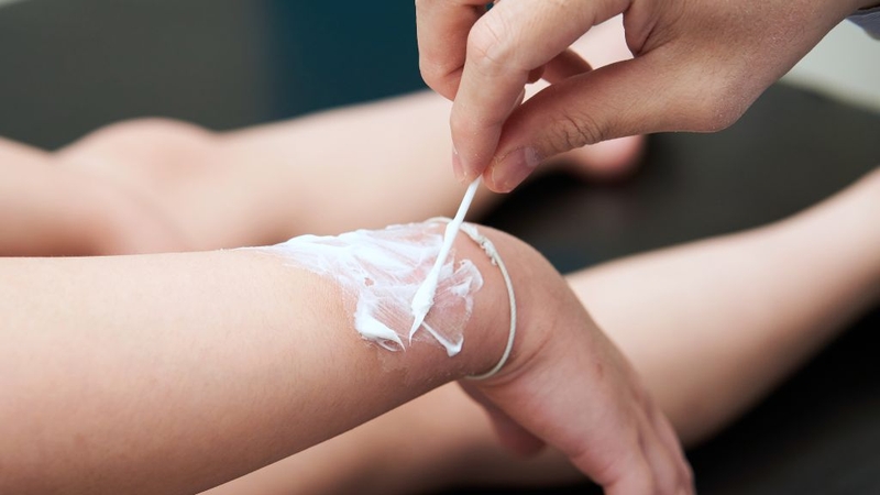 Atopic Derma Cream Lancopharm: Kem dưỡng ẩm cho người bị vẩy nến! 4