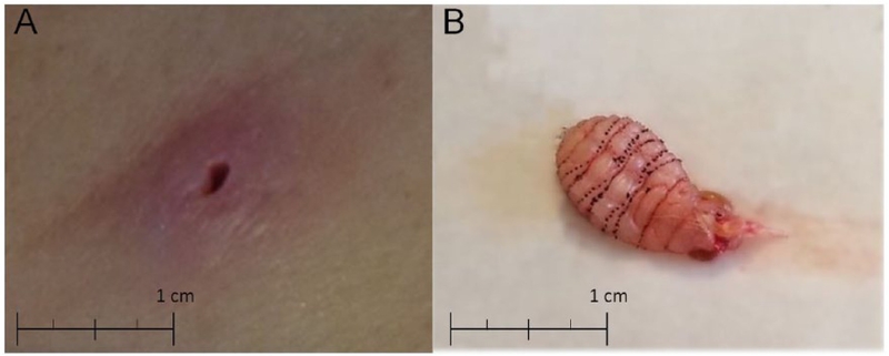 Tìm hiểu về ấu trùng ruồi trâu 3