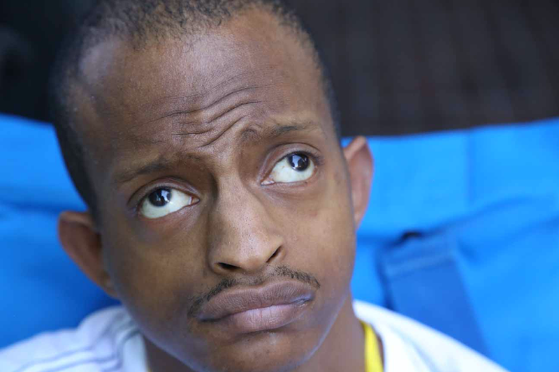 Trẻ bị hội chứng Wolf - Hirschhorn