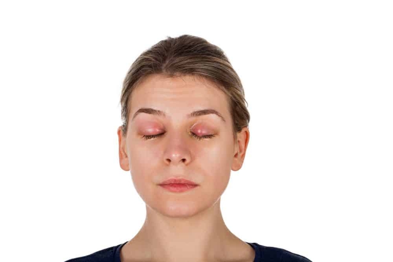 Bà bầu bị lên chắp mắt phải làm sao 2