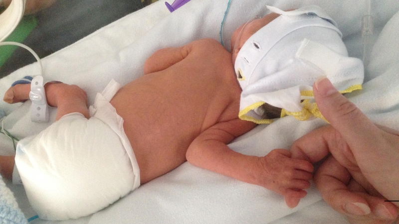 Bà bầu bị sởi có nguy hiểm không? Dấu hiệu, nguyên nhân, cách phòng tránh và xử lý 1