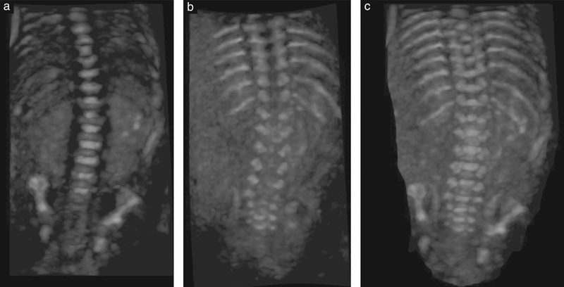 Bà bầu bị tê tay có phải thiếu canxi hay không? 3