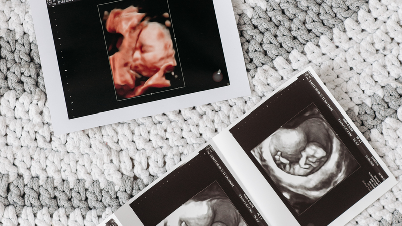 Cần chú ý lượng nước cần thiết theo từng giai đoạn thai kỳ