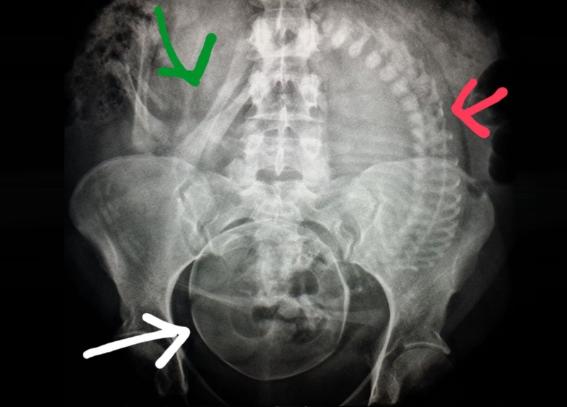 Giải đáp thắc mắc bà bầu vào phòng chụp X-quang có sao không 1