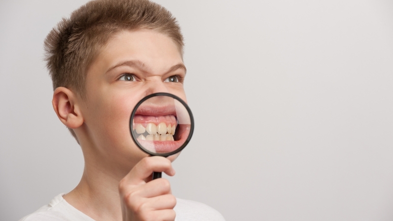 Bã đậu amidan là gì? Nguyên nhân, dấu hiệu và cách điều trị hiệu quả 2