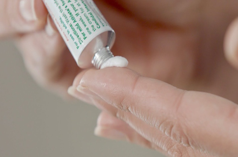 Giải đáp: Bạch biến là gì? Bạch biến có di truyền không? 4