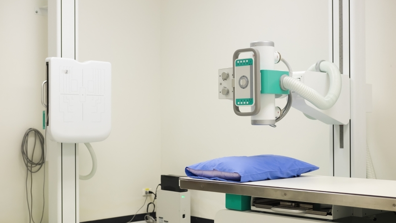 Chụp X-quang ngực giúp đánh giá tổn thương phổi
