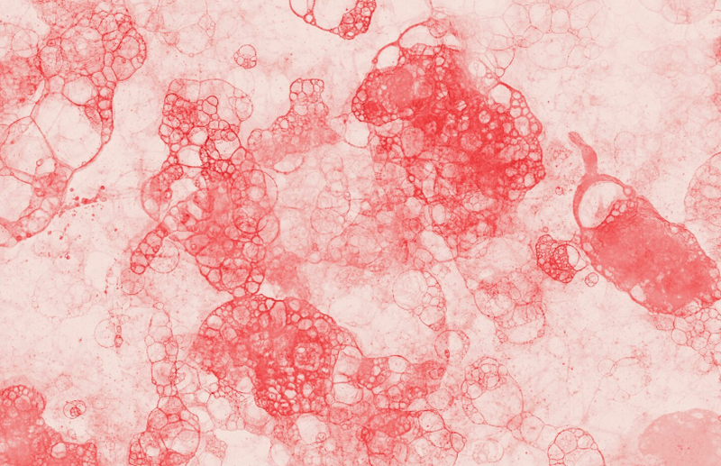 Bạch cầu là gì? Tìm hiểu chức năng và ý nghĩa của chỉ số bạch cầu 1