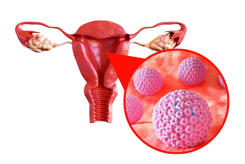 Bách hợp là gì? Có phải bệnh không? 3