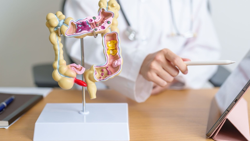 Những điều cần biết về Bacillus Coagulans 2