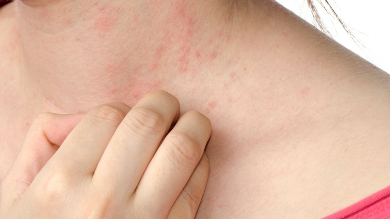 Bacsulfo là thuốc gì? Những điều lưu ý khi sử dụng thuốc Bacsulfo 3