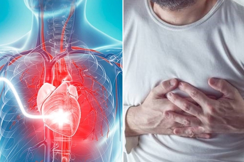 4 xét nghiệm chẩn đoán nhồi máu cơ tim cơ bản và phổ biến nhất hiện nay 1