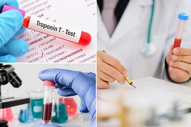 4 xét nghiệm chẩn đoán nhồi máu cơ tim cơ bản và phổ biến nhất hiện nay 3
