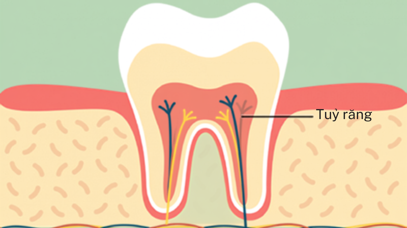 Tủy răng là phần lõi sống chứa mạch máu và thần kinh bên trong răng