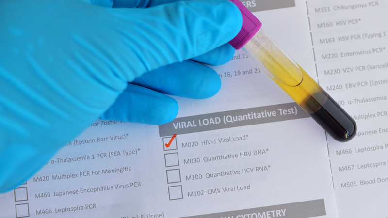 Các xét nghiệm chuyên sâu giúp đánh giá chính xác tình trạng virus