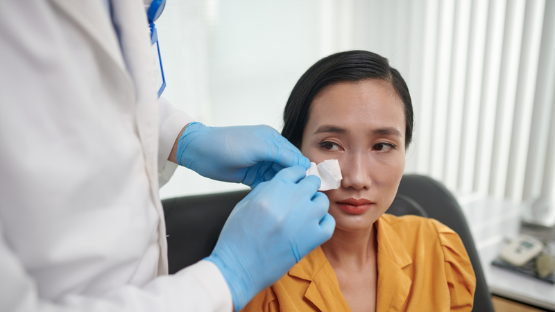 Biến chứng nâng mũi có thể do kỹ thuật thực hiện, chăm sóc hậu phẫu hoặc cơ địa