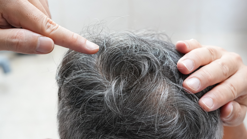 Dầu gội phủ bạc phù hợp với người tóc bạc nhiều, bạc sớm hoặc muốn che phủ tóc bạc nhanh và an toàn