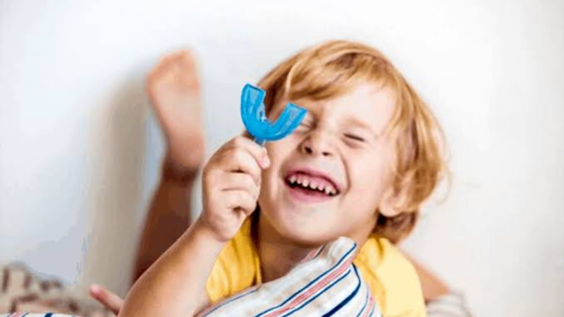 Tuân thủ hướng dẫn sử dụng để đạt hiệu quả chỉnh nha tốt nhất