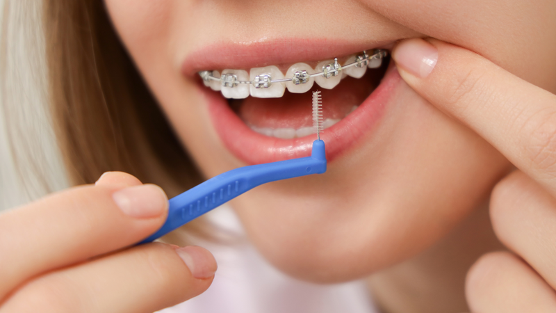 Sử dụng các dụng cụ chuyên dụng giúp làm sạch răng miệng hiệu quả