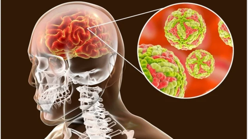 Mùa viêm não Nhật Bản thường từ tháng 5 đến tháng 10, nguy cơ cao nhất vào tháng 6 và 7