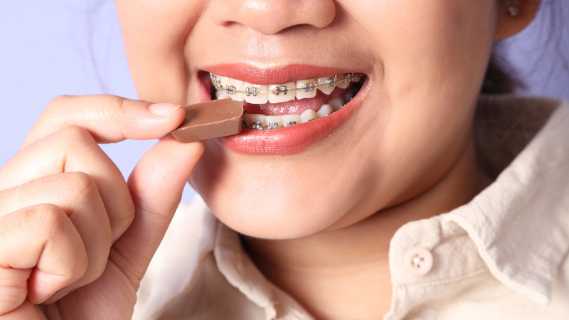 Niềng răng ăn gì? Lựa chọn thực phẩm mềm giúp giảm áp lực lên răng và khí cụ niềng