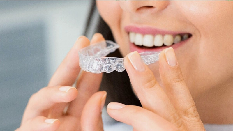 Thời gian điều trị Invisalign phụ thuộc vào tình trạng răng, kế hoạch điều trị và mức độ tuân thủ của mỗi người