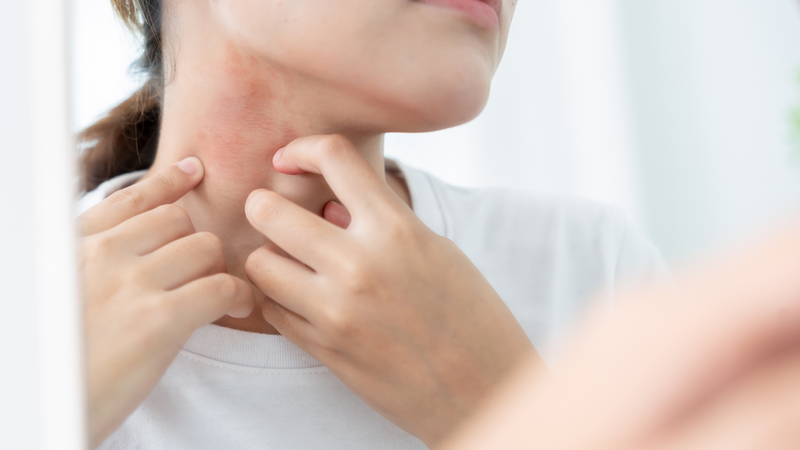 Lục bình giúp thanh nhiệt, giải độc và hỗ trợ giảm mụn nhọt, rôm sảy