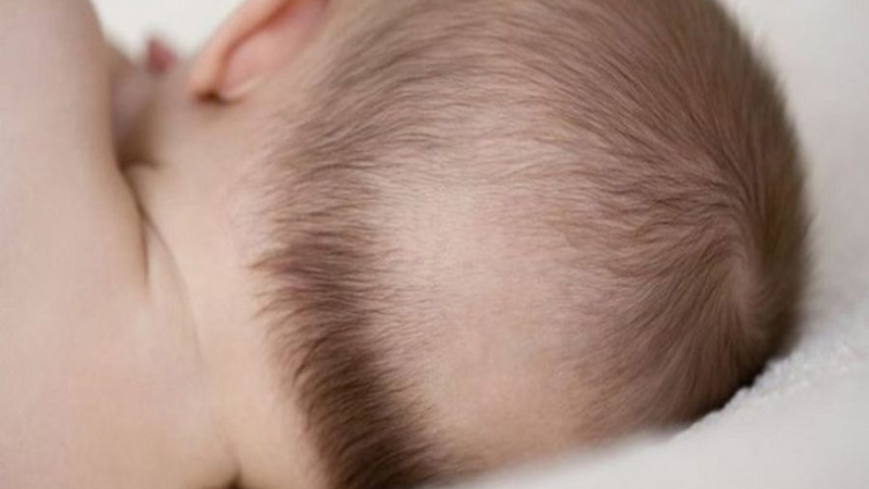 Cha mẹ nên đưa trẻ đi khám nếu rụng tóc đi kèm các dấu hiệu bất thường khác