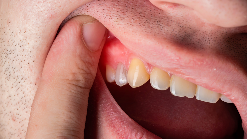 Hiểu rõ cơ chế sưng viêm giúp bạn yên tâm hơn trong quá trình hồi phục