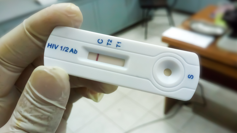 Kết quả test nhanh HIV có thể bị ảnh hưởng bởi thời điểm xét nghiệm, loại test và kỹ thuật thực hiện