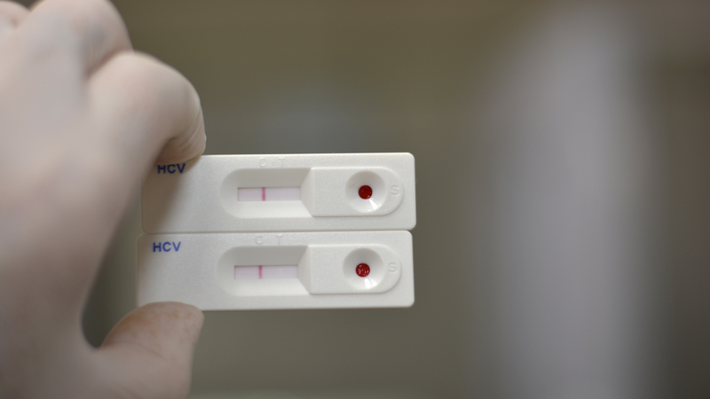 Quy trình test nhanh viêm gan C đơn giản và cho kết quả nhanh chóng
