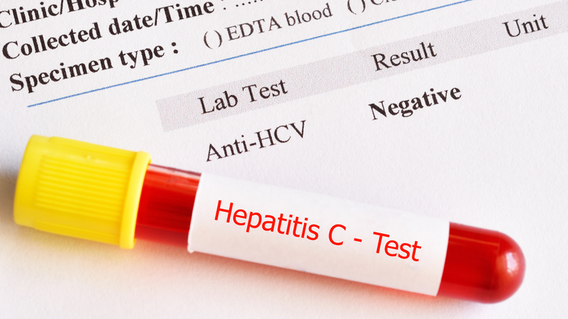 Test nhanh viêm gan C có độ chính xác cao nhưng vẫn cần xét nghiệm khẳng định trong một số trường hợp