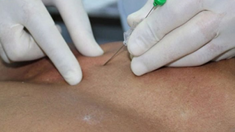 Thủy châm cần thực hiện đúng chỉ định và bởi người có chuyên môn để đảm bảo an toàn