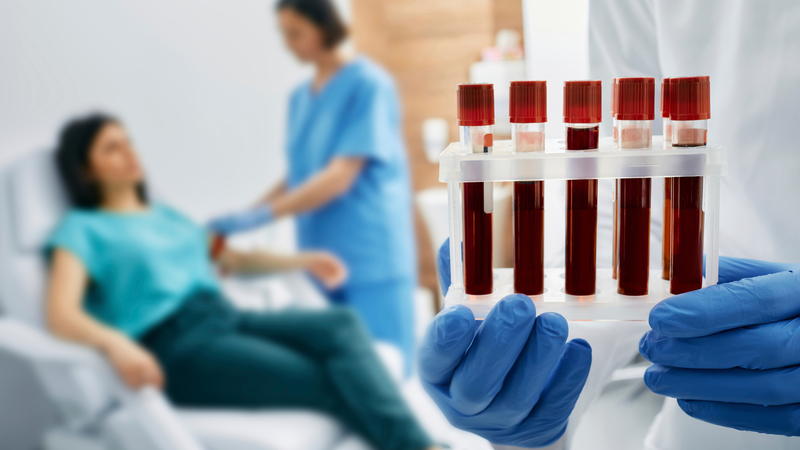 Xét nghiệm máu là phương pháp chính xác nhất để chẩn đoán viêm gan B