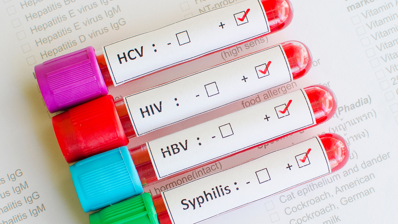 Đồng nhiễm HIV và HBV đẩy nhanh quá trình xơ hóa và tổn thương gan