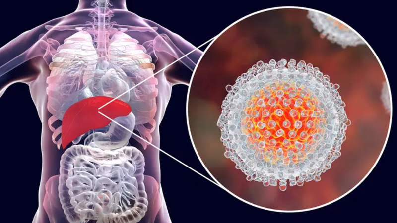 Viêm gan C cấp tính có nguy hiểm không là câu hỏi thường gặp