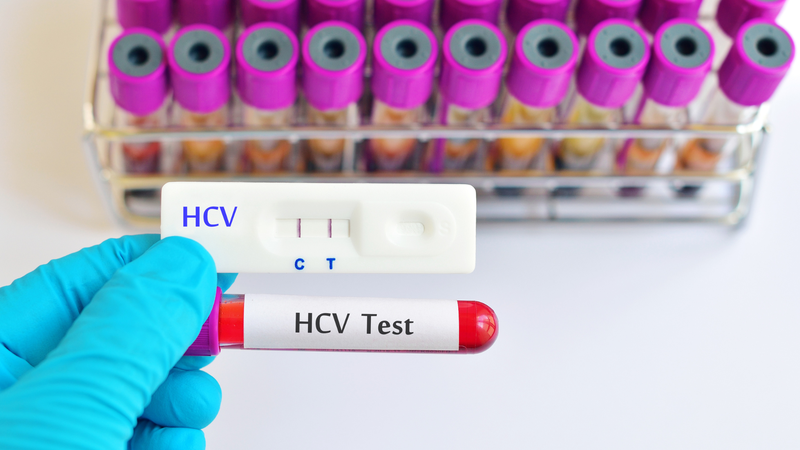 Người có nguy cơ tái nhiễm HCV nên xét nghiệm định kỳ để phát hiện sớm và điều trị kịp thời
