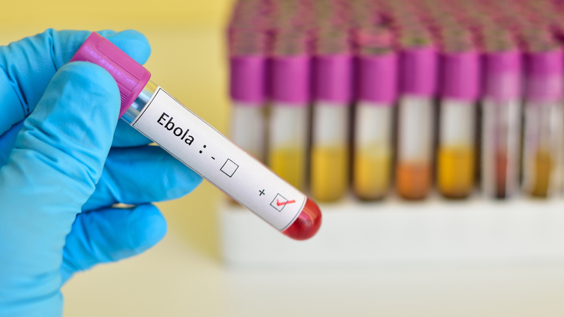 Chẩn đoán Ebola cần các xét nghiệm chuyên sâu