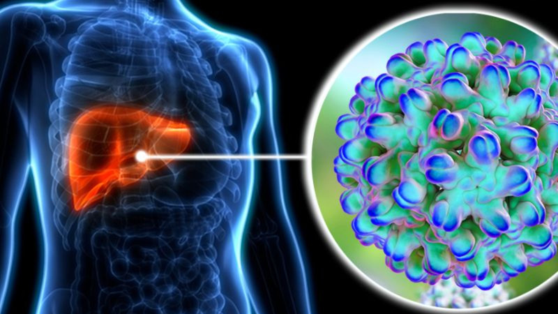 Virus viêm gan D là một loại virus không hoàn chỉnh và cần có virus viêm gan B để nhân lên