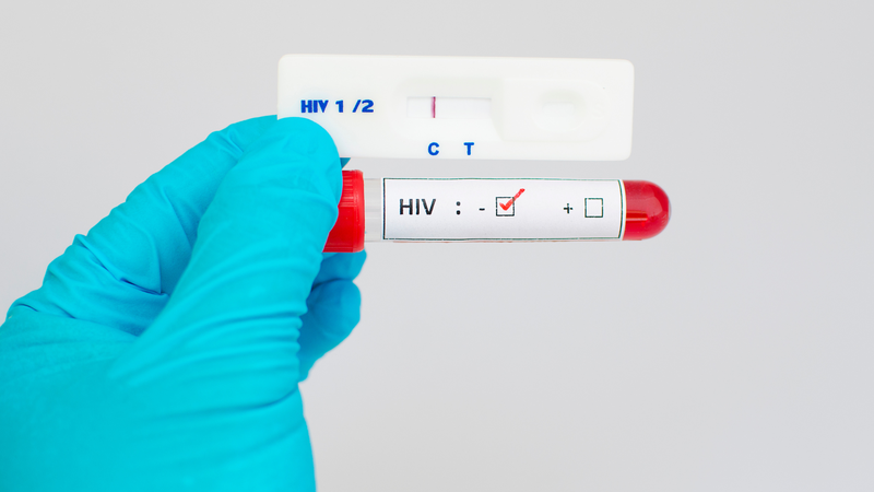 Xét nghiệm HIV âm tính sau 3 tháng thường được xem là rất đáng tin cậy nếu không có nguy cơ mới